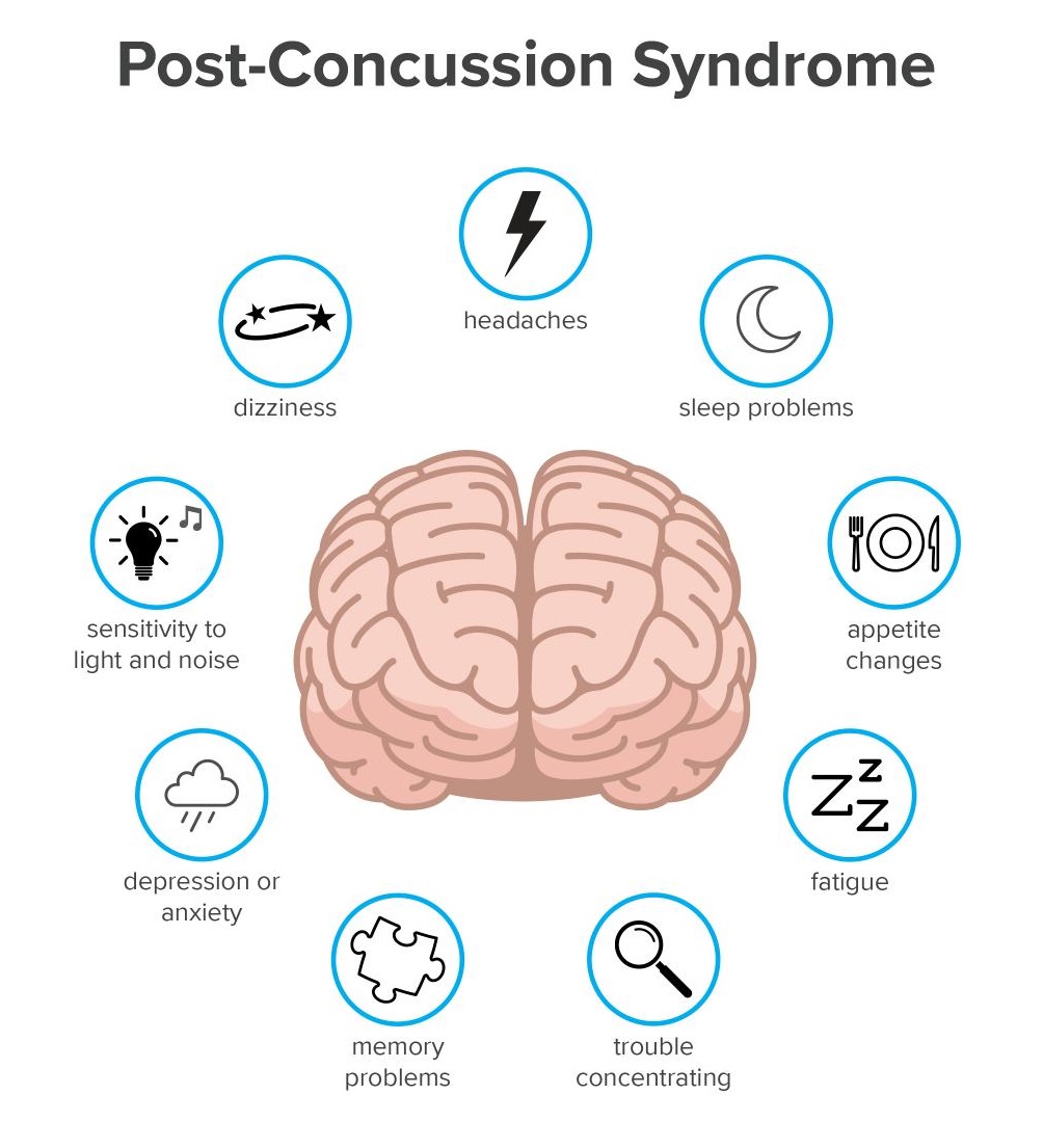 post concussion syndrome
